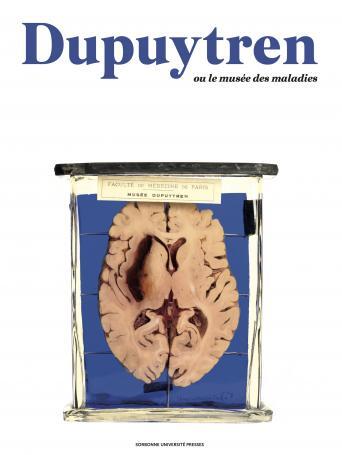 Couverture de l'ouvrage "Dupuytren" dirigé par J. Cheminaud et C. Crignon