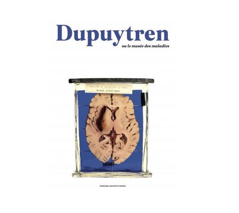 couverture du livre dupuytren ou le musée des maladies couverture du livre dupuytren ou le musée des maladies